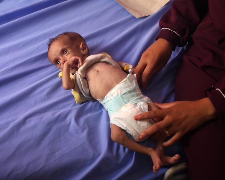 "Gaza faces shortage of critical food for starving children, UN warns"