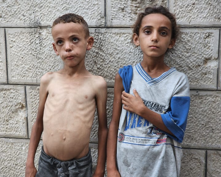 "Starving children overwhelm Gaza hospitals amid unprecedented famine crisis"