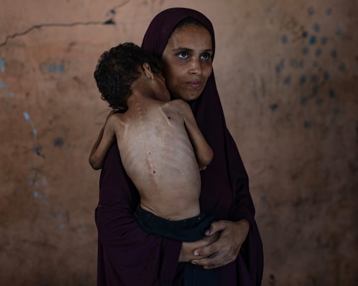 "UN-backed monitor warns of famine in Gaza amid Middle East conflict"