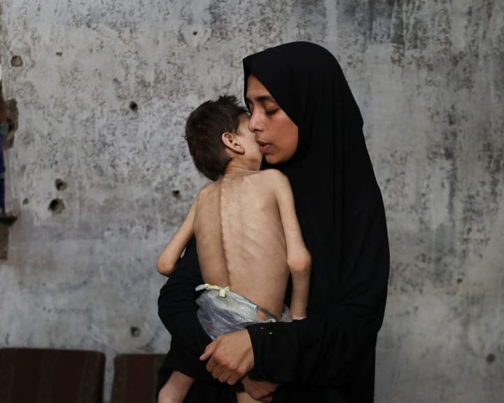 "Gaza faces starvation amid escalating crisis as desperate plea emerges: 'Save us, we are dying slowly'"