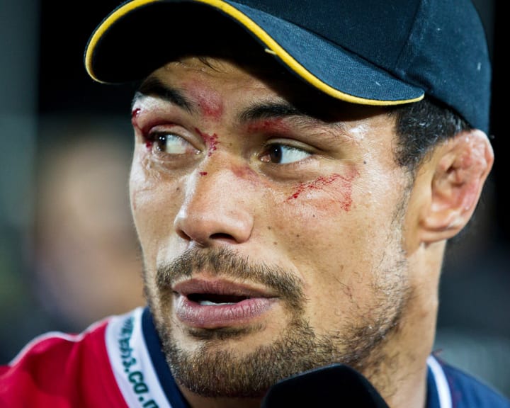 Rugby concussion advocate Shane Christie, who pledged brain donation, dies at 39