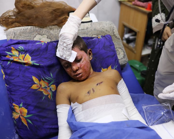 "Study: Gaza civilian wounds mirror battlefield soldier injuries"