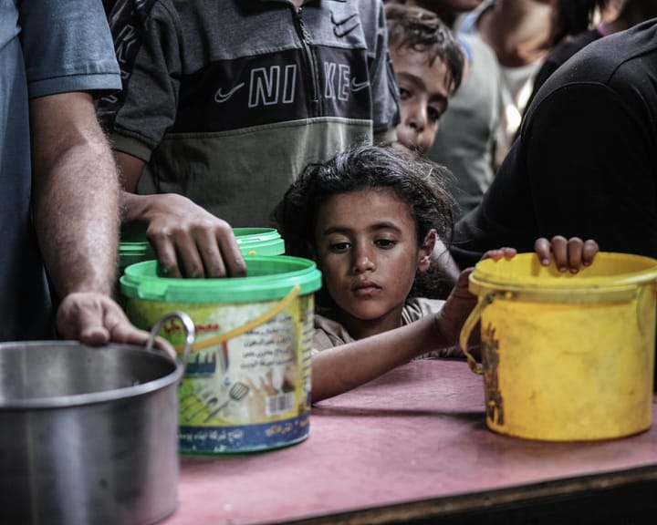 "Lancet study: Nearly 55,000 Gaza children suffer severe malnutrition"